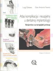 Atlas komplikacija i neuspjeha u dentalnoj implantologiji - Smjernice za terapijski pristup