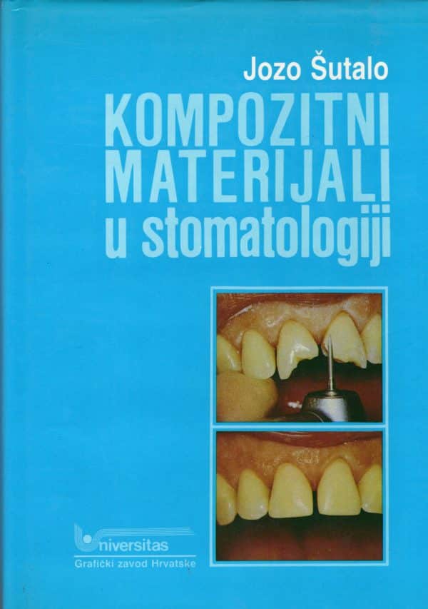 Kompozitni materijali u stomatologiji