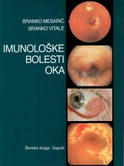 Imunološke bolesti oka