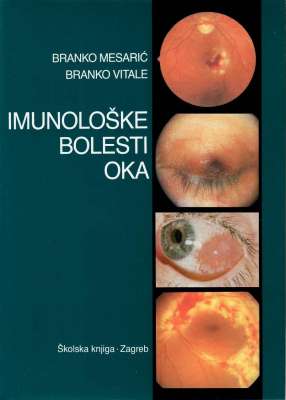 Imunološke bolesti oka